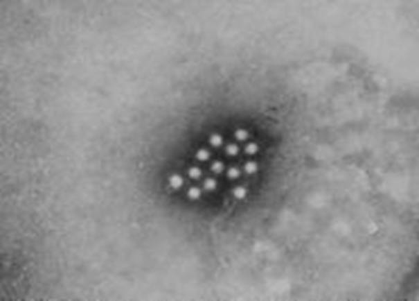 TEM micrograph of hepatitis A virions.