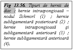 Text Box: Fig 13.56. Tipuri de hernii de disc : hernie intraspongioasa - nodul Schmorl (1) ; hernie subligamentara posterioara (2) ; hernie intraspongioasa si subligamentara anterioara (3) ; hernie subligamentara anterioara (4).







