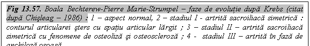 Text Box: Fig 13.57. Boala Bechterew-Pierre Marie-Strumpel - faze de evolutie dupa Krebs (citat dupa Chisleag - 1986) : 1 - aspect normal, 2 - stadiul I - artrita sacroiliaca simetrica : conturul articularei sters cu spatiu articular largit ; 3 - stadiul II - artrita sacroiliaca simetrica cu fenomene de osteoliza si osteoscleroza ; 4 - stadiul III - artrita in faza de anchiloza osoasa