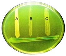 evindetiere quorum sensing.jpg