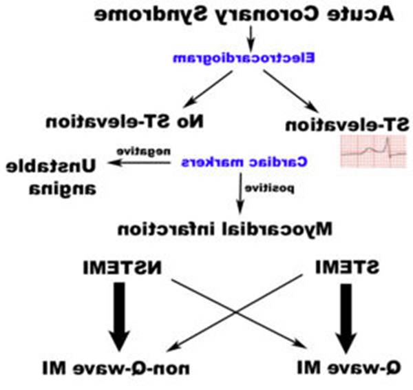 Classification of acute coronary syndromes.[24]