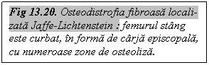 Text Box: Fig 13.20. Osteodistrofia fibroasa locali-zata Jaffe-Lichtenstein : femurul stang este curbat, in forma de carja episcopala, cu numeroase zone de osteoliza.