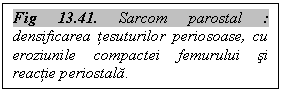 Text Box: Fig 13.41. Sarcom parostal : densificarea tesuturilor periosoase, cu eroziunile compactei femurului si reactie periostala.