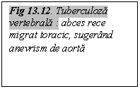 Text Box: Fig 13.12. Tuberculoza vertebrala : abces rece migrat toracic, sugerand anevrism de aorta