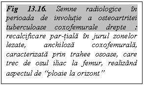 Text Box: Fig 13.16. Semne radiologice in perioada de involutie a osteoartritei tuberculoase coxofemurale drepte : recalcificare par-tiala in jurul zonelor lezate, anchiloza coxofemurala, caracterizata prin trahee osoase, care trec de osul iliac la femur, realizand aspectul de 