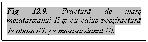 Text Box: Fig 12.9. Fractura de mars metatarsianul II si cu calus postfractura de oboseala, pe metatarsianul III.