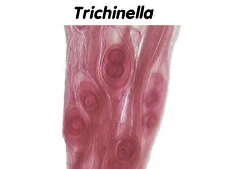 Trichinella