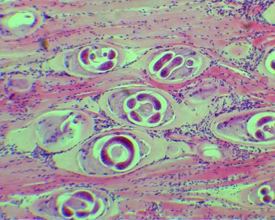 Trichinella spiralis - larve inchistate