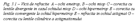 Text Box: Fig. 3.1 - Vicii de refractie A - ochi emetrop, B - ochi miop C - corectia cu lentile divergente in cazul ochiului miop D - ochi hipermetrop E - corectia cu lentile convergente la ochiul hipermetrop E - refractia in ochiul astigmat G - corectia cu lentile cilindrice a astigmatismului