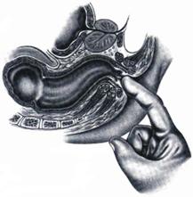 Prostata de defecatie