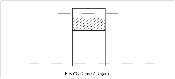 Text Box: 
Fig. 62. Coroana dintara.
